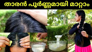 Best dandruff treatment at home❤Dandruff removal hair pack home remedy❤Best dry hair treatment@ home