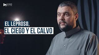 REFLEXIÓN DEL VIERNES | EL LEPROSO, EL CIEGO Y EL CALVO