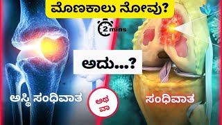 ಮೊಣಕಾಲು ನೋವು ಮತ್ತು ಸಂಧಿವಾತ | ಸಂಧಿವಾತ, ಚಿಕಿತ್ಸೆ ಮತ್ತು ಚಿಕಿತ್ಸೆ ಅಂಡರ್ಸ್ಟ್ಯಾಂಡಿಂಗ್