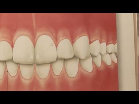 How To Have Pink Gums How To Have Pink Gums