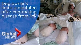 Dog owner's limbs amputated after contracting rare infection from lick