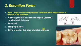 Principles of Cavity Preparation فيديو تعليمي لطلبة المرحلة الثالثة والرابعة