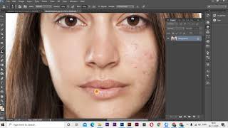 High End Skin Softening in Photoshop  Remove Blemishes, Wrinkles, Acne Scars, Dark Spots Easily