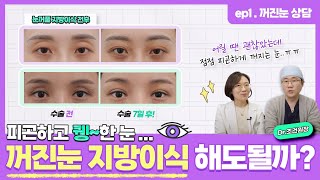 꺼진눈, 퀭한눈, 함몰눈 지방이식 상담EP.1 (고유성형외과 조건 원장)