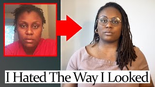 How To Deal With Locs & The “UGLY” Stage - What People DONT Tell You!
