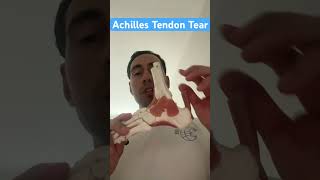 Achilles Tendon Tear #shorts #achillestendon