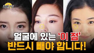 [트렌스젠더무속인] 얼굴에  이 곳 에  점은 빼시는게 좋습니다!! [점점tv]