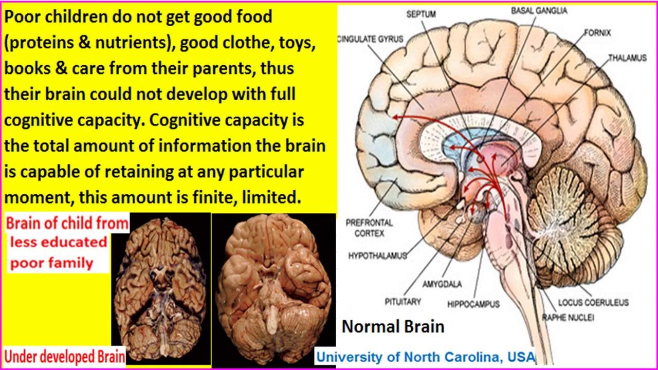 How Poverty Affects Brain Development Youtube