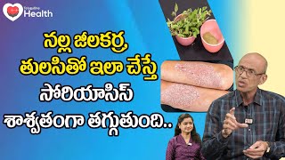 Psoriasis Remedy | నల్ల జీలకర్ర, తులసితో సోరియాసిస్ శాశ్వతంగా.. Dr Ch Madhusudana Sarma | ToneHealth