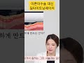 이쁜이수술 말고 질타이트닝레이저로 질벽을 쫀쫀하게 관리 비비브효과