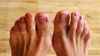 Why Do My Feet Stink? | WebMD