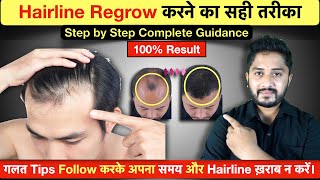 100% Result - Hairline Growth Tips 2023 | Receding Hairline से छुटकारा |