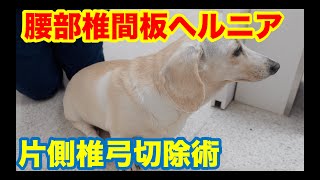 1ヶ月歩けない腰の椎間板ヘルニア