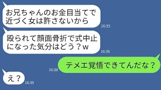 元ヤンであることを知らずに、結婚式の前日に私をバットで殴って顔を骨折させた婚約者のブラコン妹「式は中止だ、ざまあw」→勝ち誇ったDQN女を元の私に戻って成敗した結果www