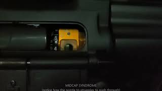 Midcap Syndrome in Super-Slow-Motion