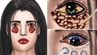 ASMR Removal Of 23 Layers Contact Lenses That Cause Microbial \u0026 Bacterial Keratitis | JINJJA 진짜 ASMR