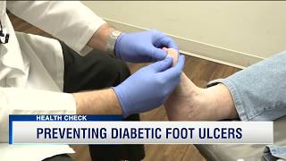 Preventing Dangerous Foot Ulcers