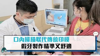 【CNEWS】「口內掃瞄」取代傳統印模 假牙製作精準又舒適