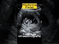 Cursos de USG Ultrassonografia Medicina Fetal #cursomedico #ultrassonografista