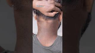 Remove Neck Darkness At Home In 5min | Neck Cleaning Tips | Dark Neck Remove Home Remedies #shorts