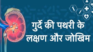 गुर्दे की पथरी के लक्षण और जोखिम | Kidney Stones Symptoms and Risk