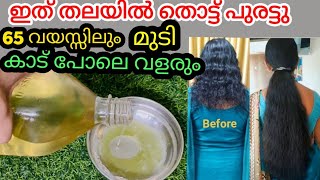 ഇത് തലയിൽ തൊട്ട്പുരട്ടു 65 വയസ്സിലും മുടി കാട് പോലെ വളരും|എത്ര വളരാത്ത മുടിയും ഭ്രാന്തുപോലെ വളരും256