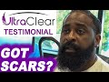 Helps with Scars for People of ALL SKIN TYPES | UltraClear Non-Surgical Laser