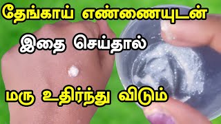 தேங்காய் எண்ணையுடன் இதை செய்தால் மரு உதிர்ந்து விடும் | Remove Skin Tags at Home