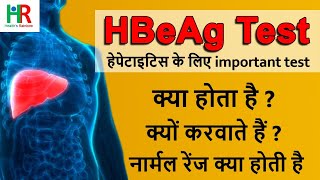 hepatitis B e Antigen ( HBeAg) test in hindi | hbeag negative means | hbeag positive means