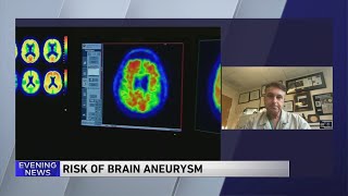 Doctor discusses risks of aneurysms