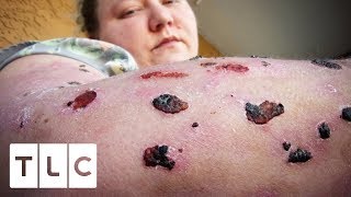 Living With The World’s Most Painful Disease | Body Bizarre