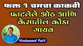 फक्त 1 चमचा काकवी अशी वापरा; फाटलेले ओठ, केसातील कोंडा गायब;वैद्य पाटील। dandruff removal treatment