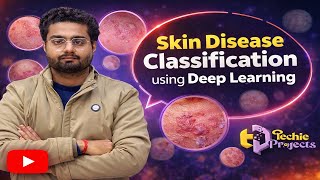 Skin Disease Classification using Deep Learning | Machine Learning Projects for Final Year