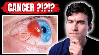 Do Sunglasses Cause Skin Cancer?! The Truth From an Eye Doctor