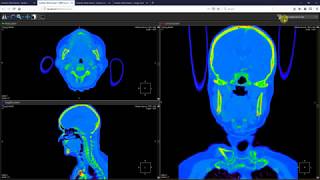 Inobitec DICOM Viewer Web Interface