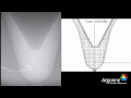 Argonne National Laboratory Needle Simulation