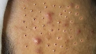 Satisfying Relaxing with Sac Dep Spa Video (#186)