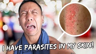 I Have Parasites Living In My Skin | Vlog #490