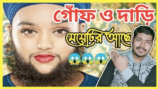 এই মেয়েটির দাড়ি ও গোঁফ রয়েছে l female with beard l Amazing facts in Bengali l Gayan Papi