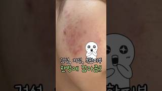 지성피부 건성피부 복합성피부 다모여랏!!이 그린그린 조합이면 다 커버될거예요✨*어떻게 써야하는지 맞춤 사용 가이드 궁금한 분들은1:1링크도 남겨드리니 무료 상담 꼭 받으세요^^