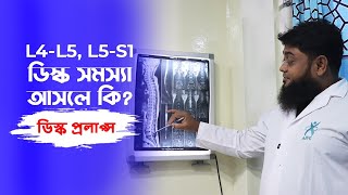 L4 L5, L5 S1 ডিস্কে সমস্যা আসলে কি?