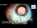 live surgery from nandadeep eye hospital dr sourabh patwardhan