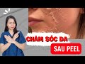 Sau khi peel da nên dùng sản phẩm gì? Chăm sóc da sau peel | Nguyễn Mai Hương