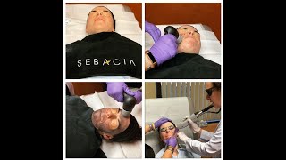 Sebacia for Acne with Dr. Rebecca Baxt