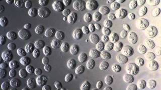 Yeast Saccharomyces Cerevisiae - DIC microscope 1000x