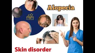 Alopecia(Hair loss)Types  ,Causes  ,Treatment