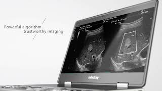 Mindray MX7 Ultrasound Promo Video - Mindray Authorized Dealer, Ultra Select Medical