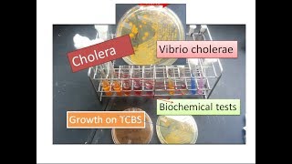 Cholera  | Vibrio cholerae