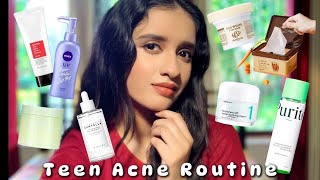 How To Cure TEEN ACNE!! #acne