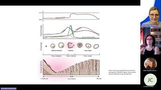 Parlons DT1 - Santé reproductive et DT1 2024.06.27